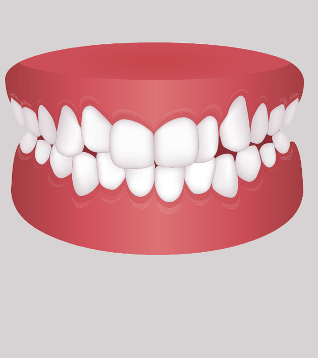 Common orthodontic issues