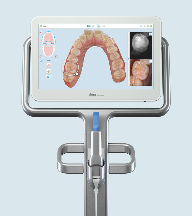 3D iTero scanner