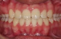 See our smile transformations