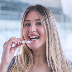 Angel Aligners Angel Aligners